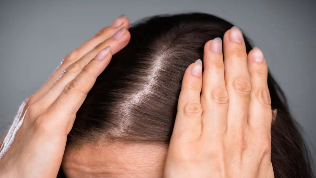 7 reasons for hair fall during festive season and tips to prevent it