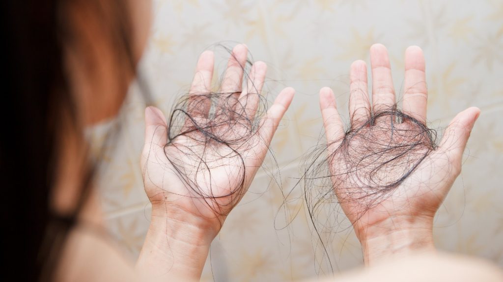 The rise of autoimmune hair loss: Causes and treatments